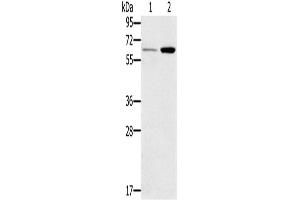 Western Blotting (WB) image for anti-Tumor Necrosis Factor Receptor Superfamily, Member 11a, NFKB Activator (TNFRSF11A) antibody (ABIN2435278) (TNFRSF11A anticorps)