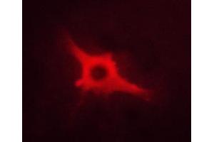 ABIN6267460 staining A673 cells by ICC/IF.