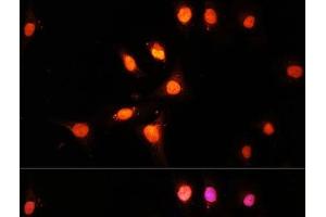 Immunofluorescence analysis of U-2 OS cells using KAT2A Polyclonal Antibody at dilution of 1:100 (40x lens). (KAT2A anticorps)