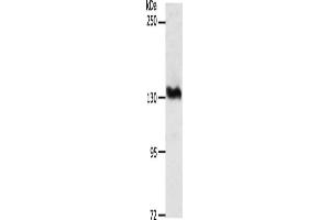 Gel: 8 % SDS-PAGE, Lysate: 40 μg, Lane: PC3 cells, Primary antibody: ABIN7189655(ADAMTS16 Antibody) at dilution 1/1350, Secondary antibody: Goat anti rabbit IgG at 1/8000 dilution, Exposure time: 30 minutes (ADAMTS16 anticorps)