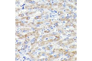 Immunohistochemistry of paraffin-embedded human liver using Glucosylceramidase beta (Glucosylceramidase beta (GBA)) Rabbit mAb (ABIN7267407) at dilution of 1:100 (40x lens). (GBA anticorps)
