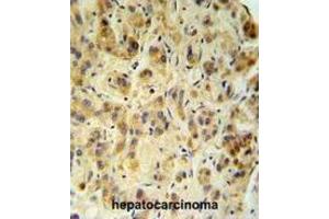 Immunohistochemistry (IHC) image for anti-Fucosidase, alpha-L- 1, Tissue (FUCA1) antibody (ABIN3002802)