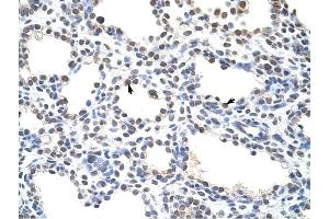 CSDC2 antibody was used for immunohistochemistry at a concentration of 4-8 ug/ml to stain Alveolar cells (arrows) in Human Lung.
