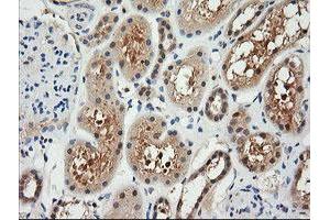 Image no. 1 for anti-Retinoic Acid Receptor Responder (Tazarotene Induced) 1 (RARRES1) antibody (ABIN1500601) (RARRES1 anticorps)