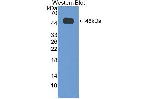 Western blot analysis of the recombinant protein. (VPS37A anticorps  (AA 1-397))