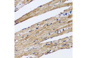Immunohistochemistry of paraffin-embedded rat heart using MAP1LC3B antibody. (LC3B anticorps)