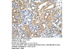 Rabbit Anti-ADAMTS4 Antibody  Paraffin Embedded Tissue: Human Kidney Cellular Data: Epithelial cells of renal tubule Antibody Concentration: 4.