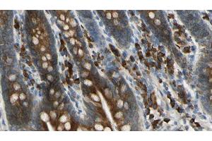 ABIN6276019 at 1/100 staining Mouse intestine tissue by IHC-P. (GPR158 anticorps  (N-Term))