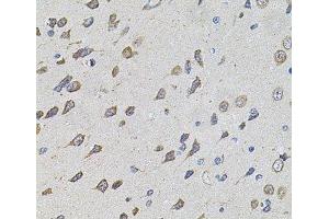 Immunohistochemistry of paraffin-embedded Rat brain using FoxO3a Polyclonal Antibody at dilution of 1:100 (40x lens). (FOXO3 anticorps)