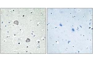 Immunohistochemistry analysis of paraffin-embedded human brain tissue, using EDG2 Antibody.