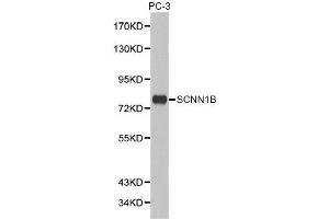 Western blot analysis of extracts of PC-3 cell lines, using SCNN1B antibody. (SCNN1B anticorps  (AA 406-640))