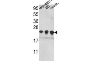 Western Blotting (WB) image for anti-Peroxiredoxin 2 (PRDX2) antibody (ABIN3001720) (Peroxiredoxin 2 anticorps)