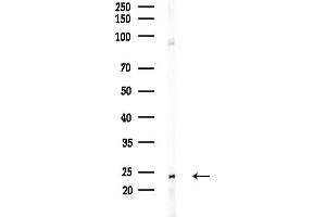 anti-BCL2-Interacting Killer (Apoptosis-Inducing) (BIK) antibody