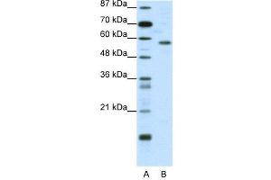 WB Suggested Anti-YY1  Antibody Titration: 0. (YY1 anticorps  (N-Term))