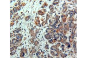 Used in DAB staining on fromalin fixed paraffin-embedded Pancreas tissue (NPTX2 anticorps)