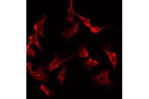 ABIN6277981 staining Hela by IF/ICC.