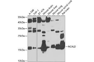 Western blot analysis of extracts of various cell lines, using NCALD antibody (ABIN6132891, ABIN6144390, ABIN6144391 and ABIN6224019) at 1:1000 dilution. (NCALD anticorps  (AA 1-193))