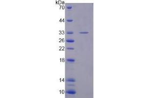 SDS-PAGE (SDS) image for phosphodiesterase 10A (PDE10A) (AA 508-779) protein (His tag) (ABIN4990452) (PDE10A Protein (AA 508-779) (His tag))