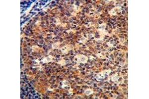 IL-12B antibody immunohistochemistry analysis in formalin fixed and paraffin embedded human tonsil tissue. (IL12B anticorps  (AA 264-290))