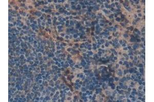 Detection of MIB2 in Mouse Spleen Tissue using Polyclonal Antibody to Mindbomb Homolog 2 (MIB2)