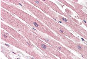 Human Heart (formalin-fixed, paraffin-embedded) stained with CASP1 antibody ABIN461892 at 5 ug/ml followed by biotinylated goat anti-rabbit IgG secondary antibody ABIN481713, alkaline phosphatase-streptavidin and chromogen. (Caspase 1 anticorps)