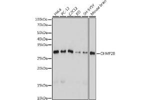 Western blot analysis of extracts of various cell lines, using CHMP2B antibody (ABIN7266290) at 1:1000 dilution. (CHMP2B anticorps)