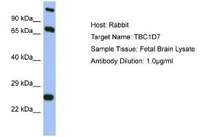 Host: Rabbit Target Name: TBC1D7 Sample Type: Fetal Brain lysates Antibody Dilution: 1. (TBC1D7 anticorps  (Middle Region))