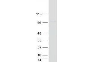 Validation with Western Blot