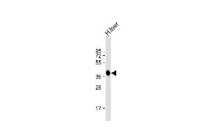 Anti-AGXT Antibody (Center)at 1:2000 dilution + human liver lysates Lysates/proteins at 20 μg per lane.