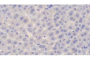 Detection of PYGM in Mouse Liver Tissue using Polyclonal Antibody to Glycogen Phosphorylase, Muscle (PYGM)