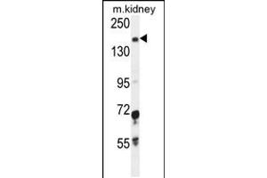 Western blot analysis in mouse kidney tissue lysates (35ug/lane). (IGSF1 anticorps  (C-Term))