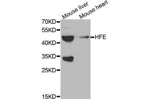 Western blot analysis of extracts of various tissues, using HFE antibody. (HFE anticorps  (AA 80-306))