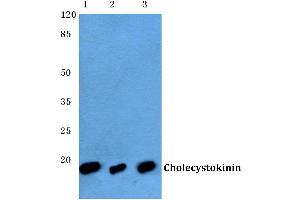 Western blot (WB) analysis of CCK antibody at 1/500 dilution (Cholecystokinin anticorps)