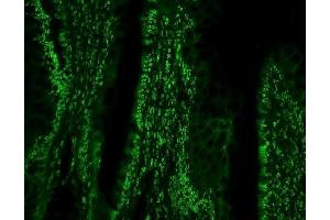 IF analysis of PTBP1 using anti-PTBP1 antibody (ABIN7599450). (PTBP1 anticorps  (AA 1-504))