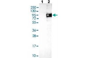 Western blot analysis of Lane 1: Negative control (vector only transfected HEK293T lysate), Lane 2: Over-expression lysate (Co-expressed with a C-terminal myc-DDK tag (~3. (ODF2 anticorps  (AA 44-205))