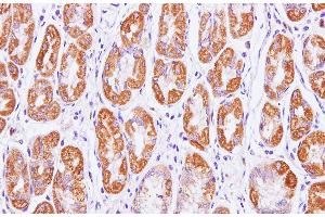 Immunohistochemistry of paraffin-embedded Human stomach using Cytochrome c1 Polyclonal Antibody at dilution of 1:100(400x) (Cytochrome C1 anticorps)