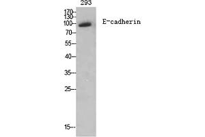 Western Blot analysis of various cells using E-cadherin Polyclonal Antibody diluted at 1:2000. (E-cadherin anticorps  (AA 810-890))