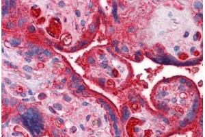 Human Placenta: Formalin-Fixed, Paraffin-Embedded (FFPE) (APOA2 anticorps  (AA 1-100))