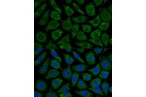 Immunofluorescence analysis of L929 cells using NDUFS2 antibody (ABIN6133022, ABIN6144484, ABIN6144485 and ABIN7101413) at dilution of 1:100.