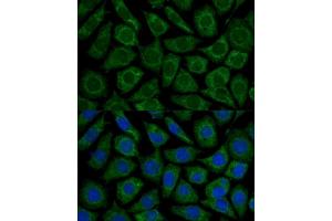 Immunofluorescence analysis of L929 cells using NDUFS2 antibody (ABIN6133022, ABIN6144484, ABIN6144485 and ABIN7101413) at dilution of 1:100. (NDUFS2 anticorps  (AA 204-463))