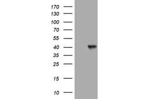 Image no. 1 for anti-Sialidase 1 (Lysosomal Sialidase) (NEU1) (AA 48-315) antibody (ABIN1491549) (NEU1 anticorps  (AA 48-315))