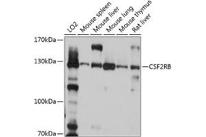 Western blot analysis of extracts of various cell lines, using CSF2RB antibody (ABIN6130049, ABIN6139098, ABIN6139099 and ABIN6214780) at 1:1000 dilution.