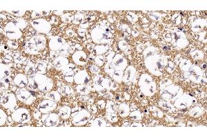 Detection of GZMB in Porcine Spinal cord Tissue using Polyclonal Antibody to Granzyme B (GZMB)