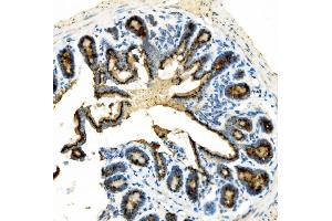 IHC analysis of Golm1/GOLPH2 using anti-Golm1/GOLPH2 antibody (ABIN7601504).