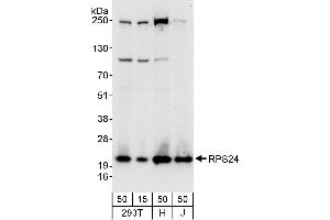 anti-Ribosomal Protein S24 (RPS24) (AA 83-133) antibody