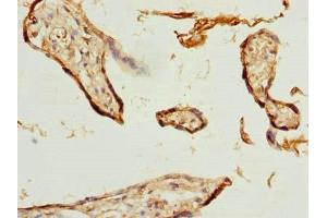 Immunohistochemistry of paraffin-embedded human placenta tissue using ABIN7176183 at dilution of 1:100 (ZNF232 anticorps  (AA 1-417))