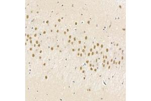 Immunohistochemistry analysis of paraffin-embedded rat brain using,HECTD1 (ABIN7074186) at dilution of 1: 2000 (HECTD1 anticorps)