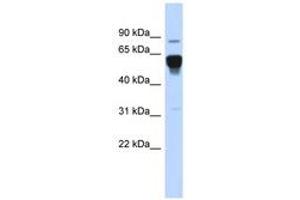 Image no. 1 for anti-Nuclear Receptor Subfamily 4, Group A, Member 2 (NR4A2) (AA 503-552) antibody (ABIN6742800) (NR4A2 anticorps  (AA 503-552))