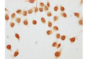 Immunocytochemistry analysis of ABIN7139201 diluted at 1:5 and staining in Hela cells (treated with 30mM sodium butyrate for 4h) performed on a Leica BondTM system.