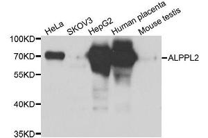Western blot analysis of extracts of various cell lines, using ALPPL2 antibody. (ALPPL2 anticorps  (AA 20-280))